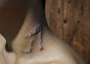 Adolescente de 13 anos é marcado no pescoço com ferro de gado em fazenda no Acre; polícia investiga caso