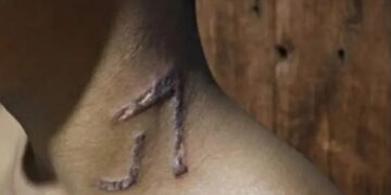 Adolescente de 13 anos é marcado no pescoço com ferro de gado em fazenda no Acre; polícia investiga caso